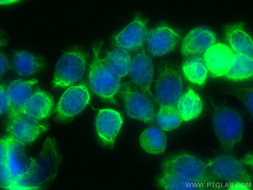 [CL488-60183-100UL] CoraLite®488-conjugated Cytokeratin 20 Monoclonal antibody