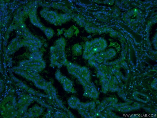[CL488-60207-100UL] CoraLite®488-conjugated Galectin-3 Monoclonal antibody