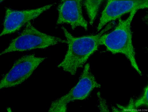 [CL488-60228-100UL] CoraLite®488-conjugated Cytoglobin Monoclonal antibody