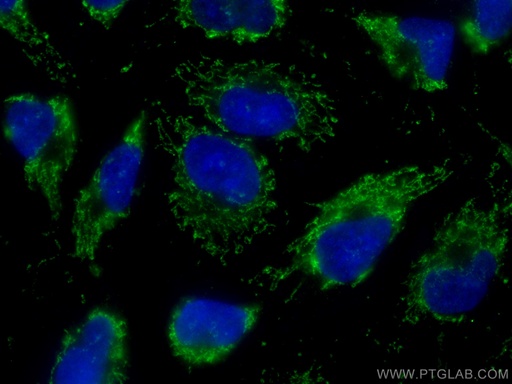 [CL488-60259-100UL] CoraLite®488-conjugated Napsin A Monoclonal antibody