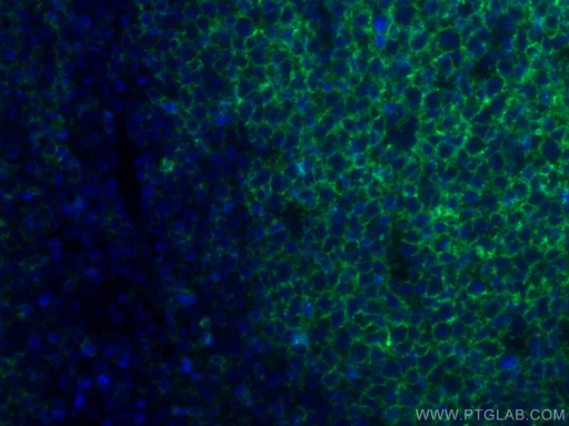 [CL488-60271-100UL] CoraLite®488-conjugated CD20 Monoclonal antibody