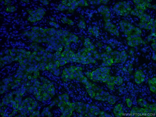 [CL488-60291-100UL] CoraLite®488-conjugated TNF Alpha Monoclonal antibody