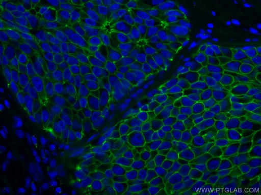 [CL488-60335-100UL] CoraLite®488-conjugated E-cadherin Monoclonal antibody