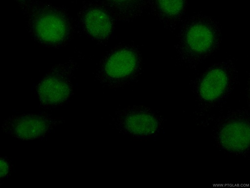 [CL488-66016-100UL] CoraLite®488-conjugated Transketolase Monoclonal antibody