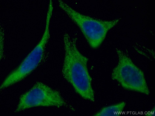 [CL488-66026-100UL] CoraLite®488-conjugated MCL1 Monoclonal antibody