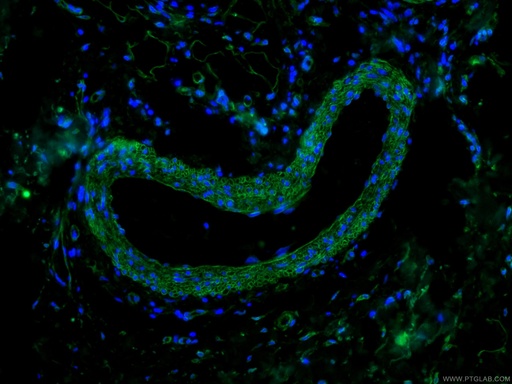[CL488-66067-100UL] CoraLite®488-conjugated Caveolin-1 Monoclonal antibody