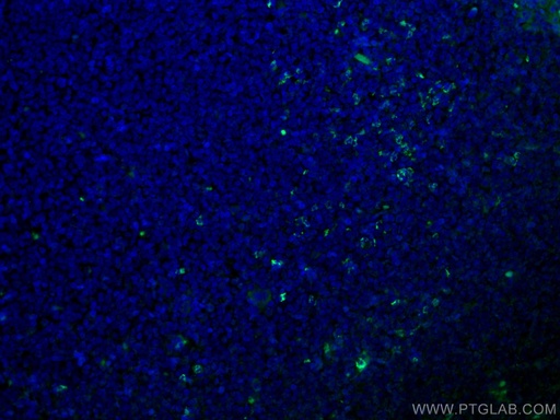 [CL488-66078-100UL] CoraLite®488-conjugated Alpha Antichymotrypsin Monoclonal antibody