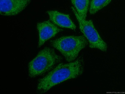 [CL488-66121-100UL] CoraLite®488-conjugated Alpha Galactosidase A Monoclonal antibody