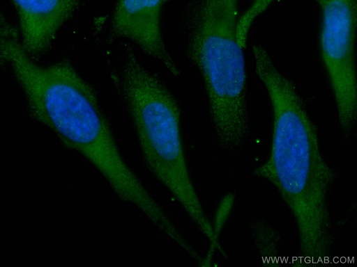 [CL488-66123-100UL] CoraLite®488-conjugated Kininogen 1 Monoclonal antibody