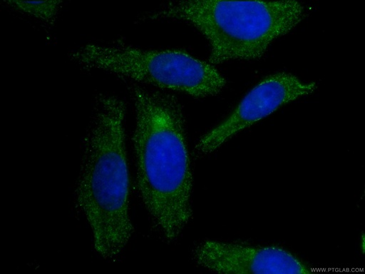 [CL488-66124-100UL] CoraLite®488-conjugated APOL1-Specific Monoclonal antibody