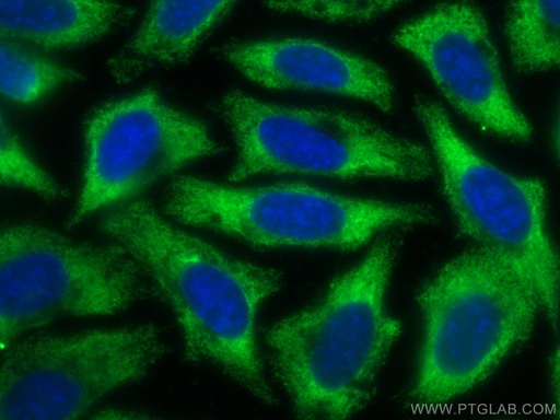 [CL488-66135-100UL] CoraLite®488-conjugated Alpha 1 Antitrypsin Monoclonal antibody