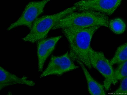 [CL488-66157-100UL] CoraLite®488-conjugated C3/C3b/C3c Monoclonal antibody