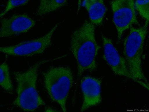 [CL488-66159-100UL] CoraLite®488-conjugated NAPRT1 Monoclonal antibody
