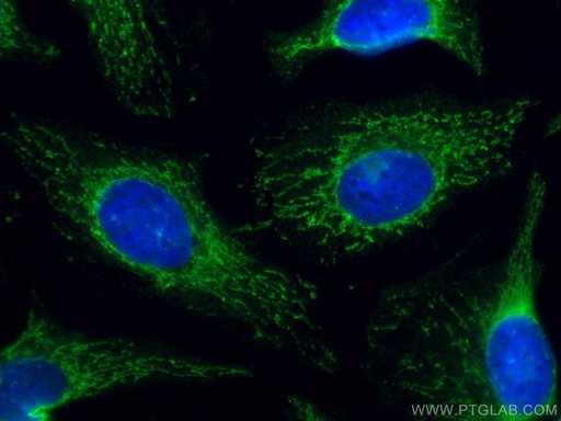 [CL488-66191-100UL] CoraLite®488-conjugated VAPB Monoclonal antibody