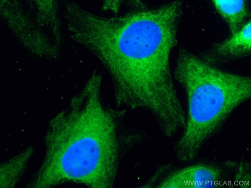 [CL488-66210-100UL] CoraLite®488-conjugated JNK Monoclonal antibody