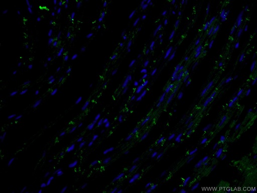 [CL488-66219-100UL] CoraLite®488-conjugated N-cadherin Monoclonal antibody