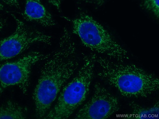 [CL488-66230-100UL] CoraLite®488-conjugated UCHL1/PGP9.5 Monoclonal antibody