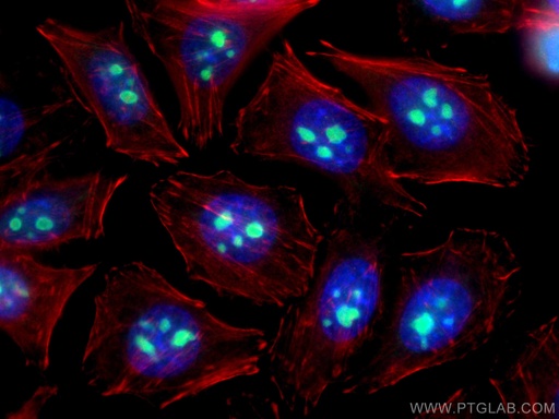 [CL488-66247-100UL] CoraLite®488-conjugated IMP3 Monoclonal antibody