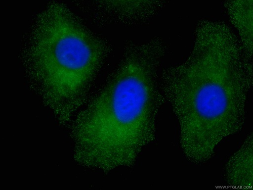 [CL488-66314-100UL] CoraLite®488-conjugated RSPO3 Monoclonal antibody