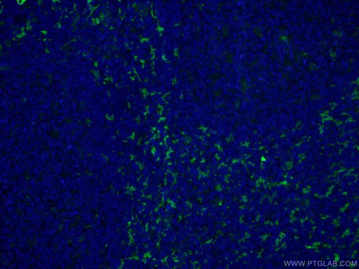 [CL488-66321-100UL] CoraLite®488-conjugated Fascin Monoclonal antibody