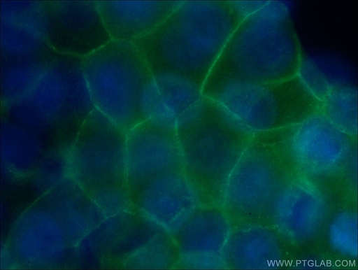 [CL488-66379-100UL] CoraLite®488-conjugated Beta Catenin Monoclonal antibody