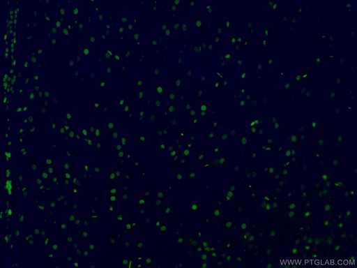 [CL488-66411-100UL] CoraLite®488-conjugated SOX2 Monoclonal antibody