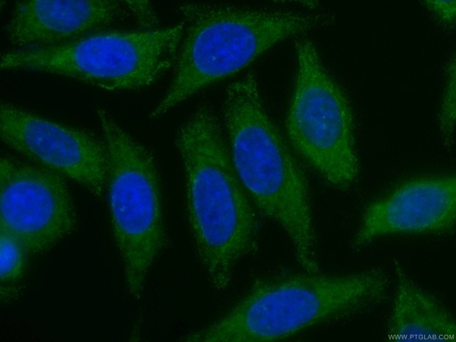 [CL488-66413-100UL] CoraLite®488-conjugated ZC3HAV1 Monoclonal antibody