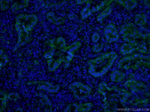 [CL488-66483-100UL] CoraLite®488-conjugated Cytokeratin 7 Monoclonal antibody