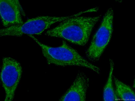 [CL488-66535-100UL] CoraLite®488-conjugated NF-κB p65 Monoclonal antibody