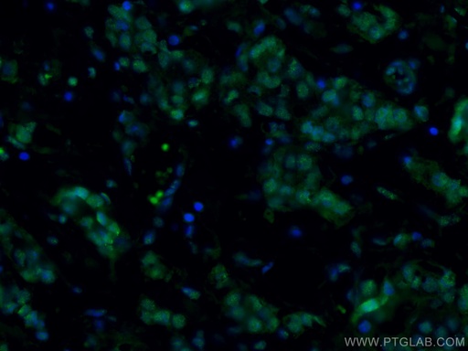 [CL488-66536-100UL] CoraLite®488-conjugated AMPK Alpha Monoclonal antibody