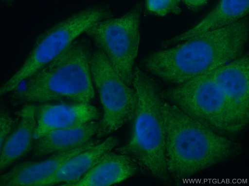 [CL488-66544-100UL] CoraLite®488-conjugated TWIST2 Monoclonal antibody