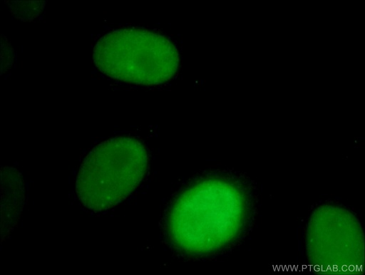 [CL488-66561-100UL] CoraLite®488-conjugated SMARCA4 Monoclonal antibody