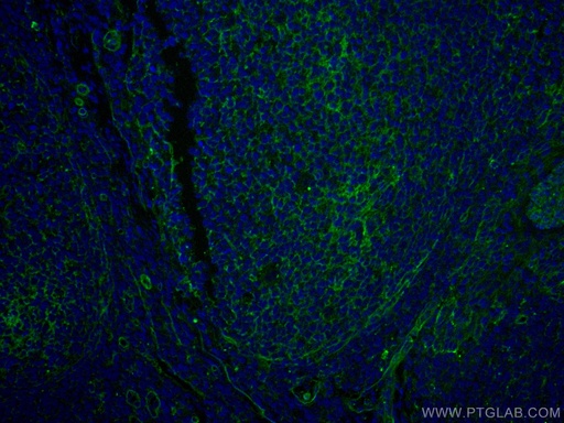 [CL488-66567-100UL] CoraLite®488-conjugated CD151 Monoclonal antibody