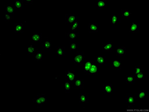 [CL488-66580-100UL] CoraLite®488-conjugated NSUN2 Monoclonal antibody