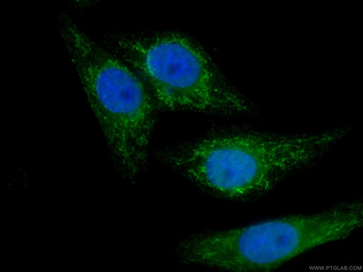 [CL488-66588-100UL] CoraLite®488-conjugated SDHA Monoclonal antibody