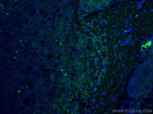 [CL488-66606-100UL] CoraLite®488-conjugated FYN Monoclonal antibody