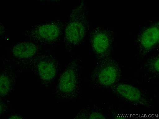 [CL488-66742-100UL] CoraLite®488-conjugated SRF Monoclonal antibody