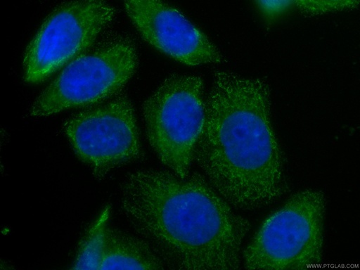 [CL488-66755-100UL] CoraLite®488-conjugated TRAF4 Monoclonal antibody