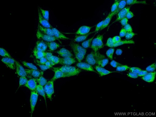 [CL488-66787-100UL] CoraLite®488-conjugated CRACR2A Monoclonal antibody