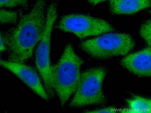 [CL488-66900-100UL] CoraLite®488-conjugated YAP1 Monoclonal antibody