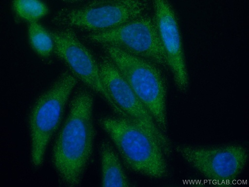 [CL488-66917-100UL] CoraLite®488-conjugated NFATC2 Monoclonal antibody