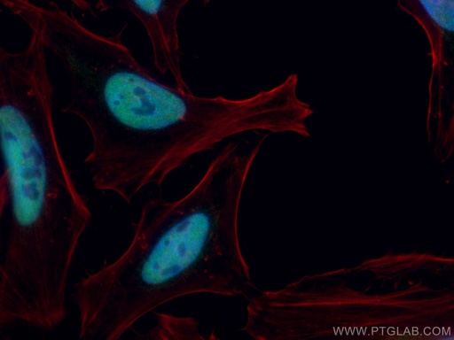 [CL488-66955-100UL] CoraLite®488-conjugated TBL1X Monoclonal antibody