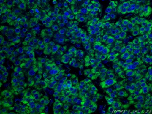 [CL488-67026-100UL] CoraLite®488-conjugated GLUD1 Monoclonal antibody
