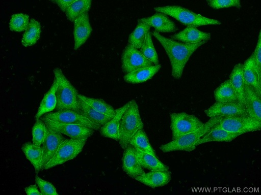 [CL488-67063-100UL] CoraLite®488-conjugated C1QA Monoclonal antibody