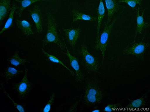 [CL488-67121-100UL] CoraLite®488-conjugated PI3 Kinase p110 Beta Monoclonal antibody