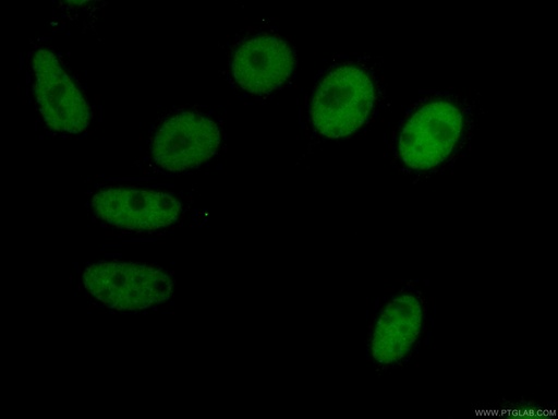[CL488-67165-100UL] CoraLite®488-conjugated HDAC2 Monoclonal antibody