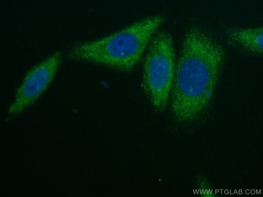 [CL488-67308-100UL] CoraLite®488-conjugated Alpha 2-Antiplasmin Monoclonal antibody