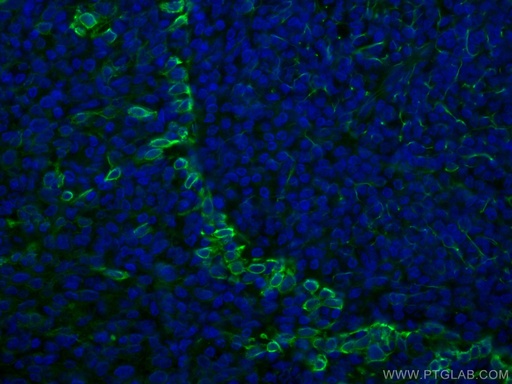 [CL488-67317-100UL] CoraLite®488-conjugated TLR8 Monoclonal antibody