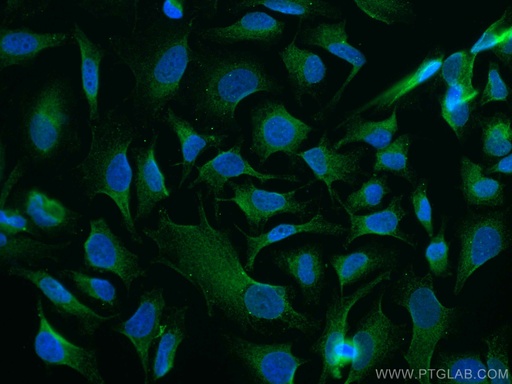 [CL488-67329-100UL] CoraLite®488-conjugated GSK3B Monoclonal antibody