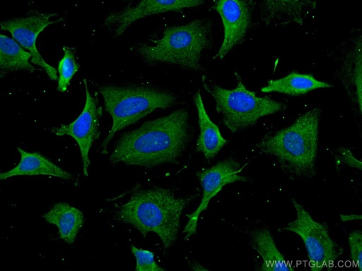 [CL488-67338-100UL] CoraLite®488-conjugated PSMD9 Monoclonal antibody